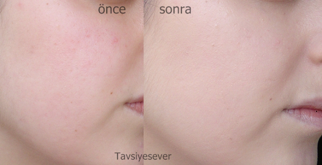 loreal lumi magique fondoten guzellik blogu